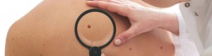 Melanoma szűrés