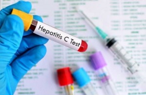 Hepatitis C-teszt
